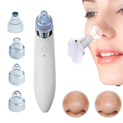 4 In 1 Portable Blackhead Derma Suction Device