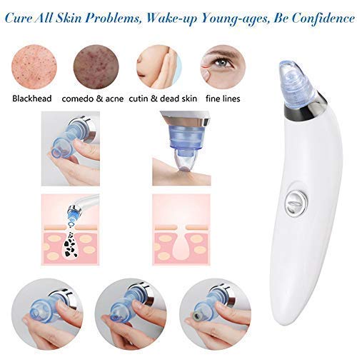 4 In 1 Portable Blackhead Derma Suction Device