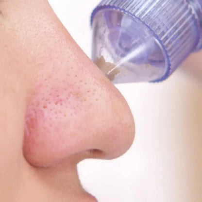 4 In 1 Portable Blackhead Derma Suction Device